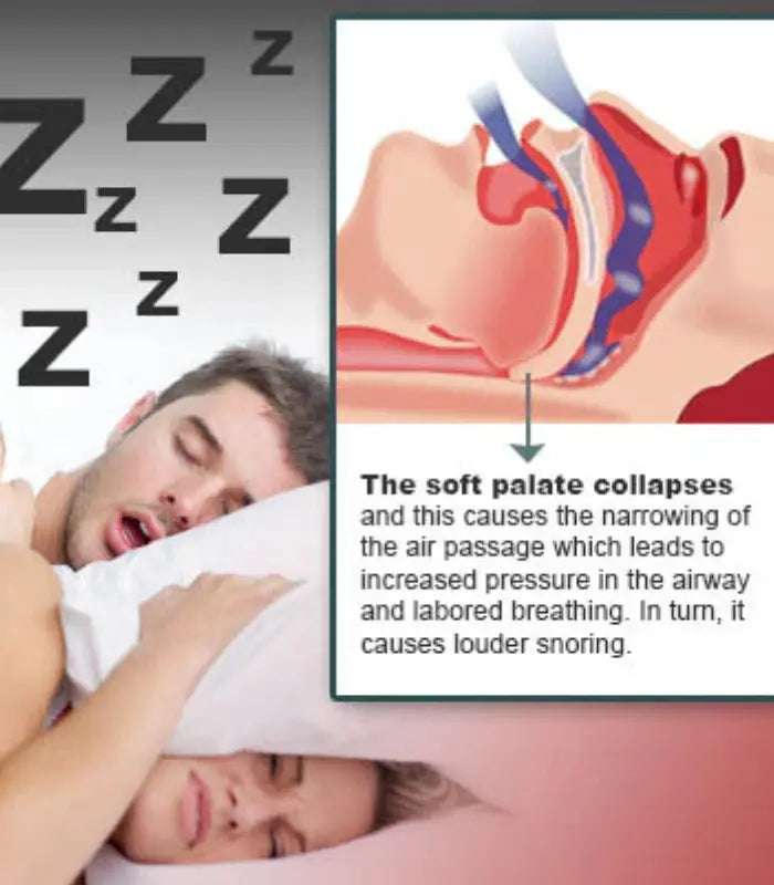 Clipair Nasal Device for Breathing & Snoring